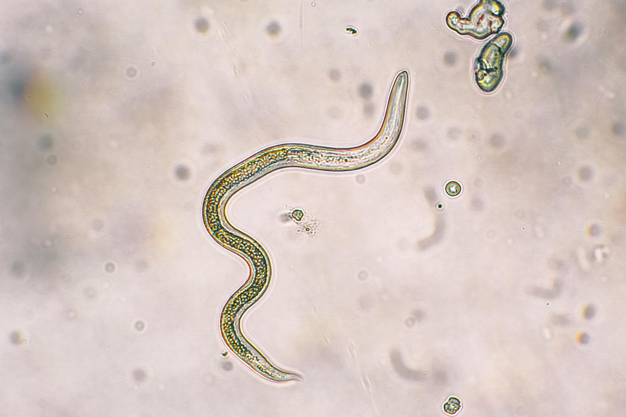 enterobius vermicularis in urine treatment