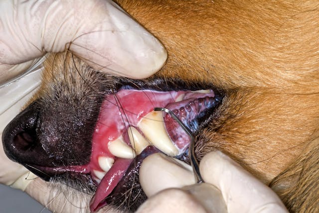 Caries Treatment - Conditions Treated, Procedure, Efficacy, Recovery, Cost, Considerations, Prevention