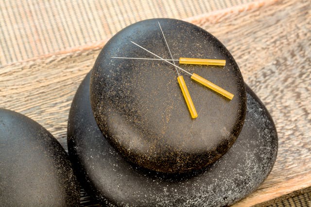 Acupuncture in Horses - Conditions Treated, Procedure, Efficacy, Recovery, Cost, Considerations, Prevention