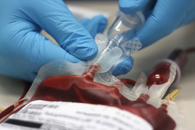 Blood Transfusion in Horses - Conditions Treated, Procedure, Efficacy, Recovery, Cost, Considerations, Prevention