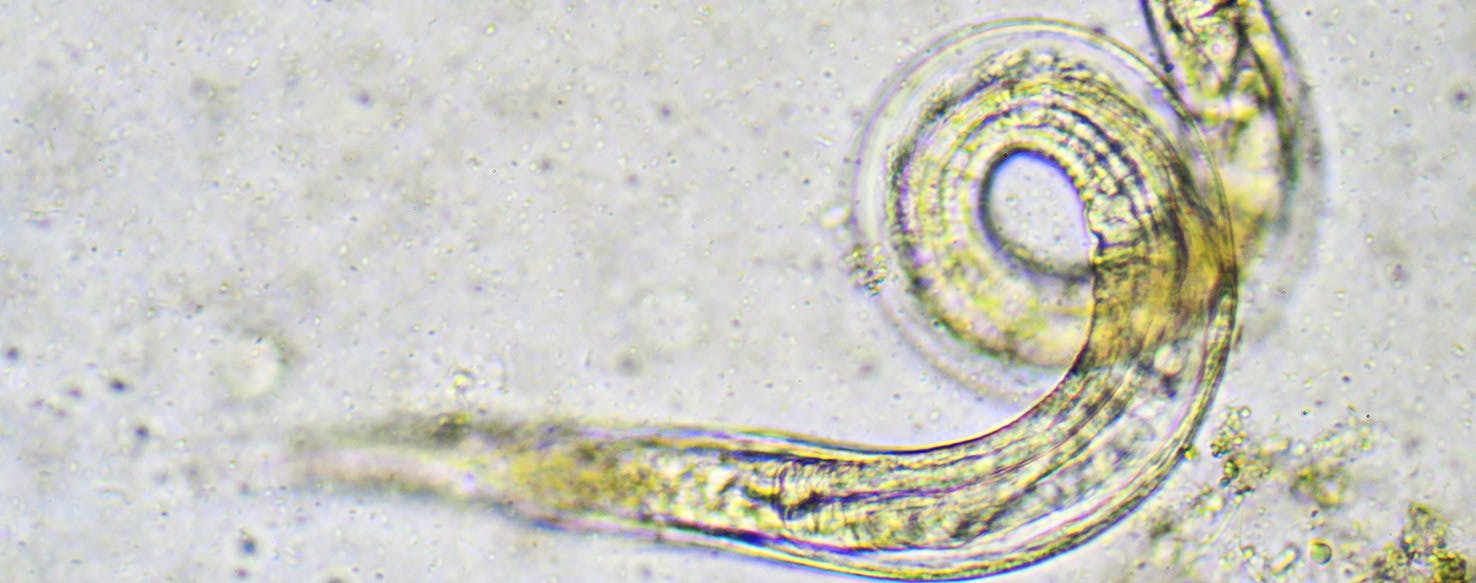 pinworms in kids poop