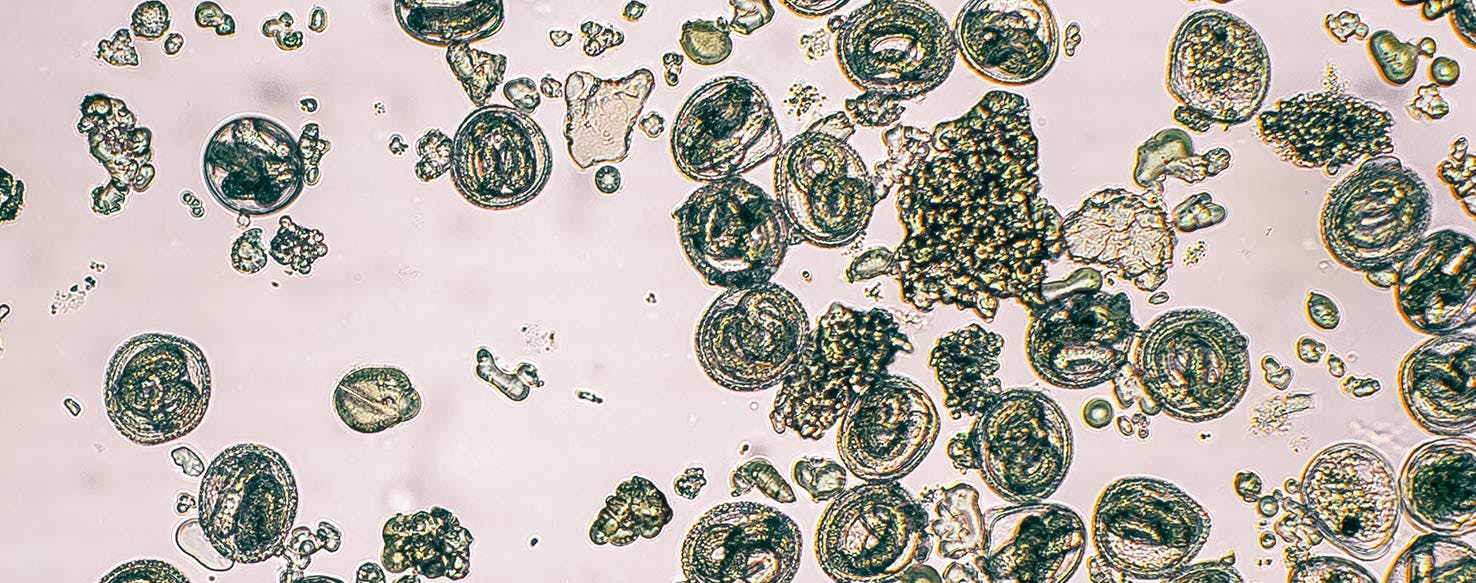 roundworms in humans