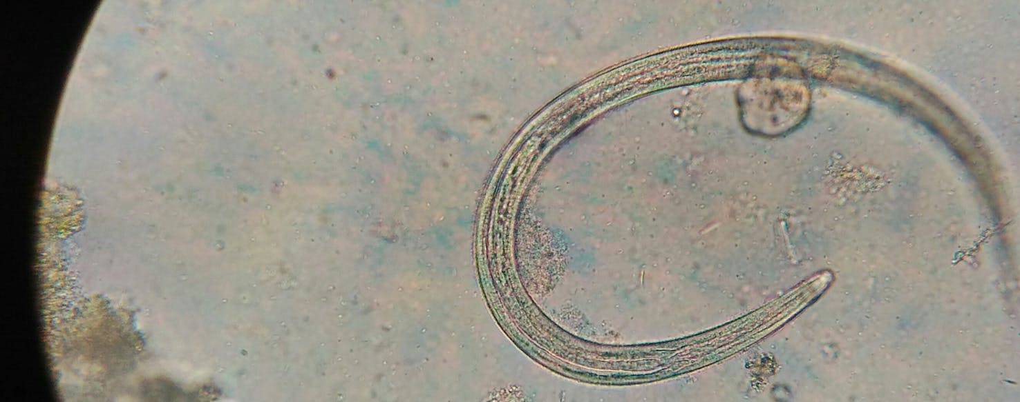 tapeworm in dogs microscope