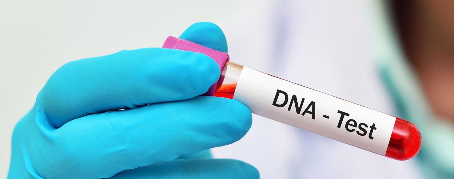 how do you get your dog dna tested